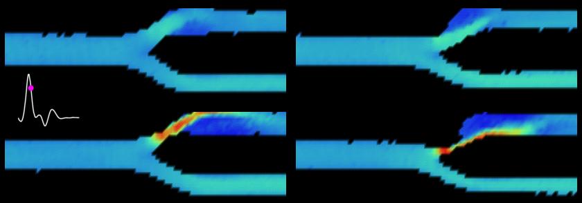 Movie of Colour doppler ultrasound emulations in the carotid bifurcation 